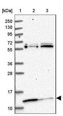 Western Blot: MRP63 Antibody [NBP1-90898]