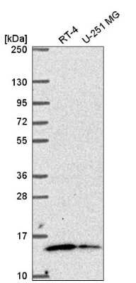 Western Blot: MRP63 Antibody [NBP2-57237]