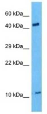 Western Blot: MRP63 Antibody [NBP3-10189]