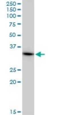 Western Blot: MRPL1 Antibody (2C4) [H00065008-M02]