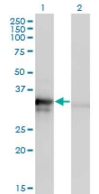 Western Blot: MRPL1 Antibody (2C4) [H00065008-M02]