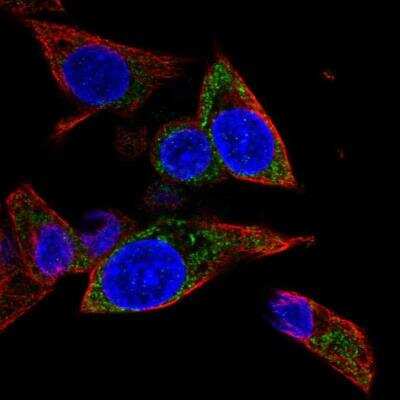 Immunocytochemistry/ Immunofluorescence: MRPL1 Antibody [NBP2-13609]