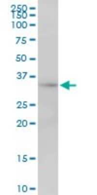 Western Blot: MRPL1 Antibody [H00065008-B01P]