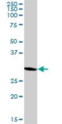 Western Blot: MRPL1 Antibody [H00065008-B01P]