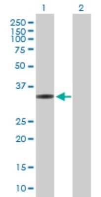 Western Blot: MRPL1 Antibody [H00065008-B01P]