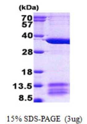 SDS-PAGE: Recombinant Human MRPL1 His Protein [NBP2-23239]