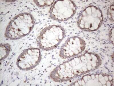 Immunohistochemistry: MRPL10 Antibody (OTI2B4) [NBP2-45910]