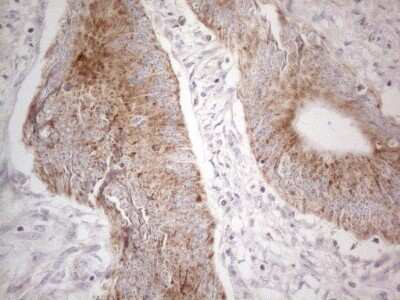 Immunohistochemistry: MRPL10 Antibody (OTI2B4) [NBP2-45910]