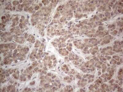 Immunohistochemistry: MRPL10 Antibody (OTI2B4) [NBP2-45910]