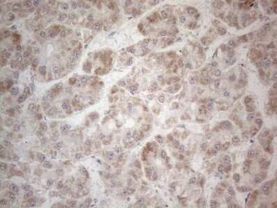 Immunohistochemistry: MRPL10 Antibody (OTI2B4) [NBP2-45910]