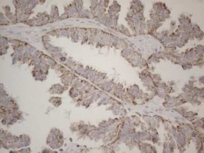 Immunohistochemistry: MRPL10 Antibody (OTI2B4) [NBP2-45910]