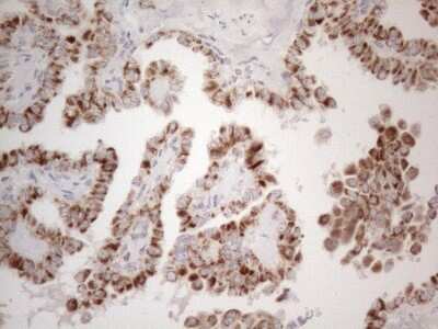 Immunohistochemistry: MRPL10 Antibody (OTI2B4) [NBP2-45910]
