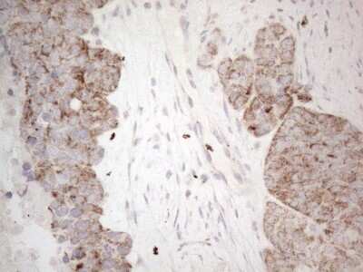 Immunohistochemistry: MRPL10 Antibody (OTI2B4) [NBP2-45910]