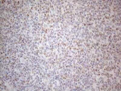 Immunohistochemistry: MRPL10 Antibody (OTI2B4) [NBP2-45910]