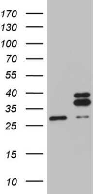 Western Blot: MRPL10 Antibody (OTI2B4) [NBP2-45910]