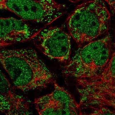 Immunocytochemistry/ Immunofluorescence: MRPL10 Antibody [NBP2-48590]