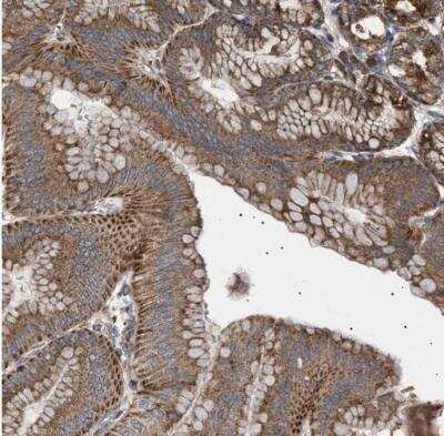 Immunohistochemistry-Paraffin: MRPL10 Antibody [NBP1-82858]