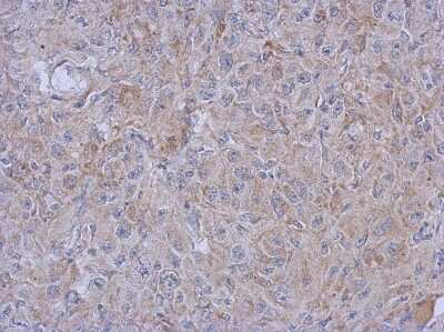 Immunohistochemistry-Paraffin: MRPL10 Antibody [NBP2-19395]
