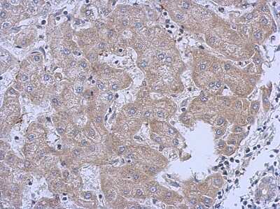 Immunohistochemistry-Paraffin: MRPL10 Antibody [NBP2-19396]