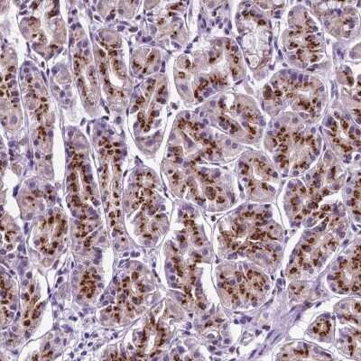Immunohistochemistry-Paraffin: MRPL10 Antibody [NBP2-48590]