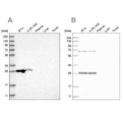 Western Blot: MRPL10 Antibody [NBP1-82858]