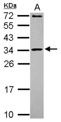 Western Blot: MRPL10 Antibody [NBP2-19395]