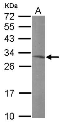 Western Blot: MRPL10 Antibody [NBP2-19396]