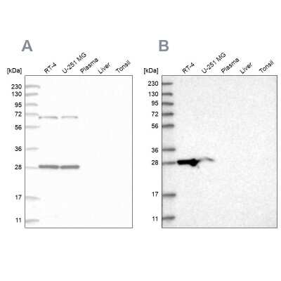 Western Blot: MRPL10 Antibody [NBP2-48590]