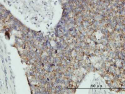 Immunohistochemistry-Paraffin: MRPL12 Antibody (3B12-1A3) [H00006182-M01]
