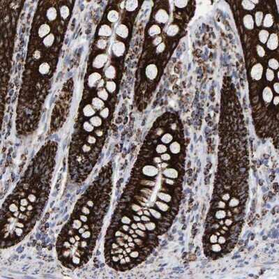 Immunohistochemistry-Paraffin: MRPL12 Antibody [NBP1-85216]