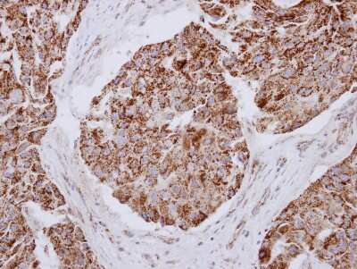Immunohistochemistry-Paraffin: MRPL12 Antibody [NBP2-19397]