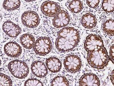 Immunohistochemistry-Paraffin: MRPL12 Antibody [NBP2-97472]