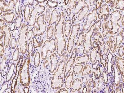 Immunohistochemistry-Paraffin: MRPL12 Antibody [NBP2-97472]