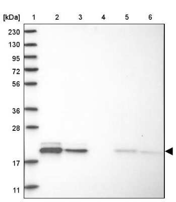 Western Blot: MRPL12 Antibody [NBP1-85216]