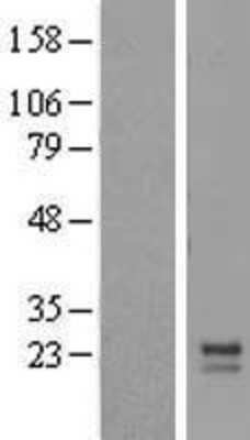 Western Blot: MRPL12 Overexpression Lysate [NBL1-13235]