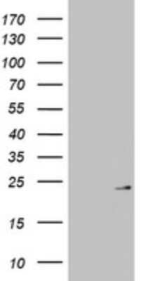 Western Blot: MRPL13 Antibody (OTI6A11) [NBP2-45935]