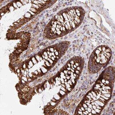 Immunohistochemistry-Paraffin: MRPL13 Antibody [NBP2-32572]