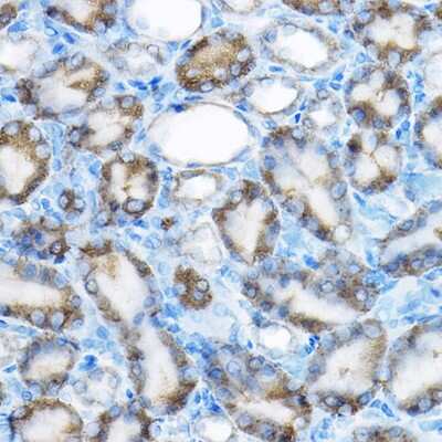 Immunohistochemistry-Paraffin: MRPL13 Antibody - BSA Free [NBP2-93661]