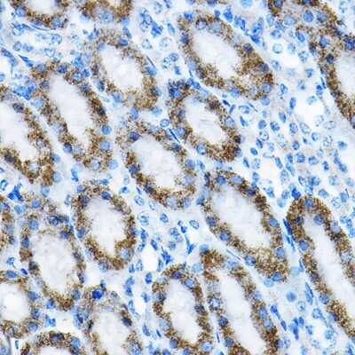 Immunohistochemistry-Paraffin: MRPL13 Antibody - BSA Free [NBP2-93661]