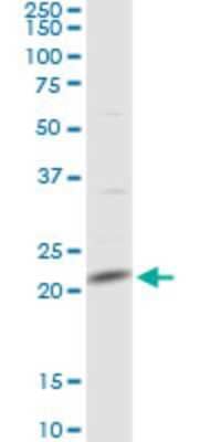 Western Blot: MRPL13 Antibody [H00028998-D01P]