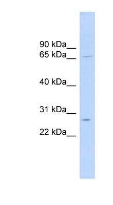 Western Blot: MRPL13 Antibody [NBP1-57600]