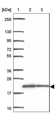 Western Blot: MRPL13 Antibody [NBP2-32572]