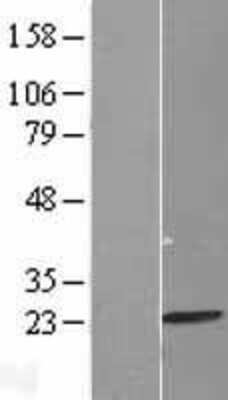 Western Blot: MRPL13 Overexpression Lysate [NBL1-13236]