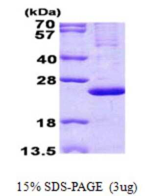 SDS-PAGE: Recombinant Human MRPL13 His Protein [NBP2-23240]