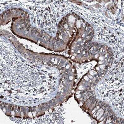 Immunohistochemistry-Paraffin: MRPL14 Antibody [NBP1-81031]