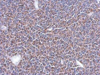 Immunohistochemistry-Paraffin: MRPL14 Antibody [NBP2-19398]