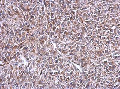 Immunohistochemistry-Paraffin: MRPL14 Antibody [NBP2-19398]