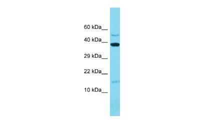 Western Blot: MRPL14 Antibody [NBP2-87822]