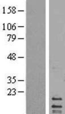 Western Blot: MRPL14 Overexpression Lysate [NBL1-13237]