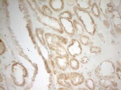 Immunohistochemistry: MRPL15 Antibody (OTI7A3) [NBP2-45936]